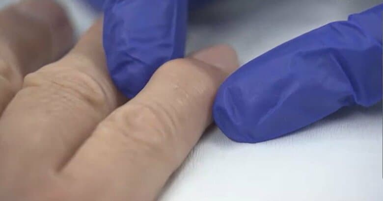 （提供：オクノクリニック銀座）