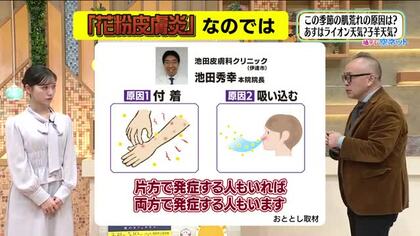 【福島県・3月6日の天気】花粉大量飛散…肌荒れしていませんか？