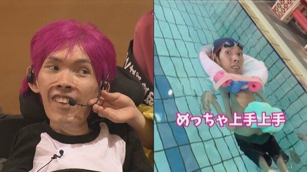 わずかに動く指先で“福祉革命”を…難病の36歳社長が日本初の無料介護