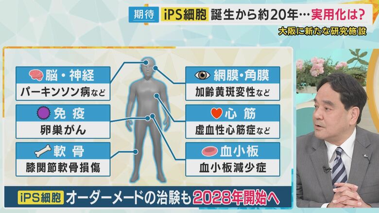 iPS細胞を活用した治療の研究