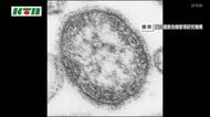  麻しん（はしか）の患者発生　全国的に感染者数が増加　頭痛や倦怠感などの症状　長崎市内2例目