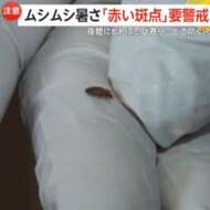 「赤い斑点」に要警戒！ホテルや旅館でトコジラミ被害か？夜間に忍び寄り100カ所以上「眠れないほどのかゆみ長く続く」一体どう防ぐ？