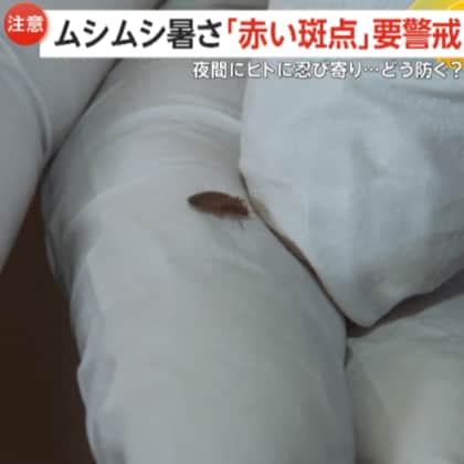 「赤い斑点」に要警戒！ホテルや旅館でトコジラミ被害か？夜間に忍び寄り100カ所以上「眠れないほどのかゆみ長く続く」一体どう防ぐ？