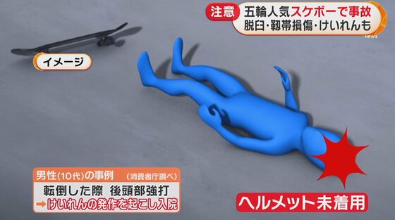 五輪で人気 スケートボード 事故の多くは小学生 骨折が半数 頭を強く打つと障害も 対策は 五輪で人気 スケートボード 事故の多くは小学生 骨折が半数 頭を強く打つと障害も 対策は