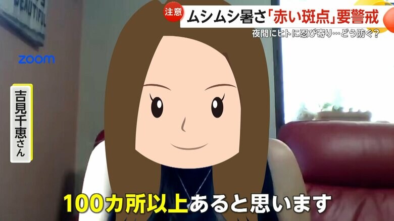 トコジラミに100箇所以上刺される被害にあった吉見千恵さん