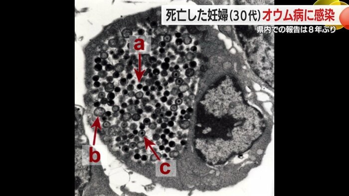 検体検査で判明(提供:感染症情報提供サイト)