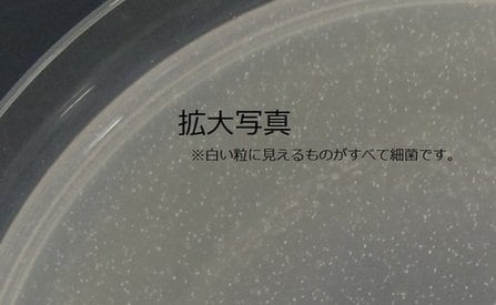 増殖した菌の拡大写真（提供：宇都宮市衛生環境試験所）