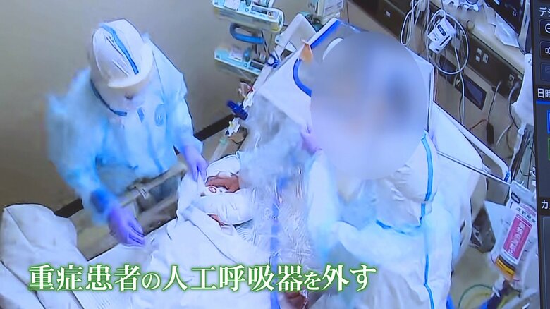 人工呼吸器を外す様子