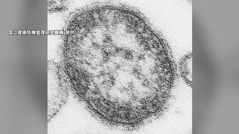 新宿の飲食店で9人「はしか」集団感染…強い感染力　合併症で命落とすケースも　ワクチン2回接種と感染防御が重要