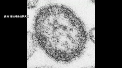 0歳の男の子がはしか感染　ワクチン接種受けず海外から1日に入国　区役所で接触した職員150人に健康観察　東京・台東区