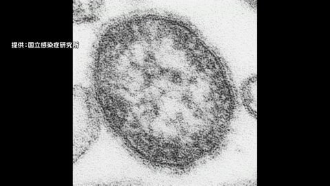 0歳の男の子がはしか感染　ワクチン接種受けず海外から1日に入国　区役所で接触した職員150人に健康観察　東京・台東区