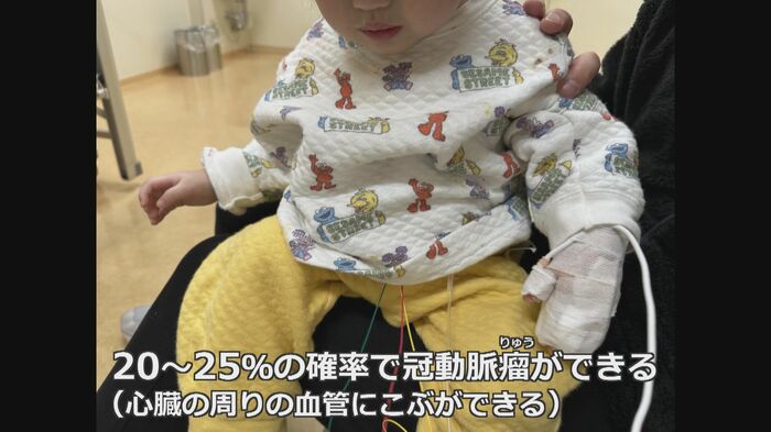 川崎病