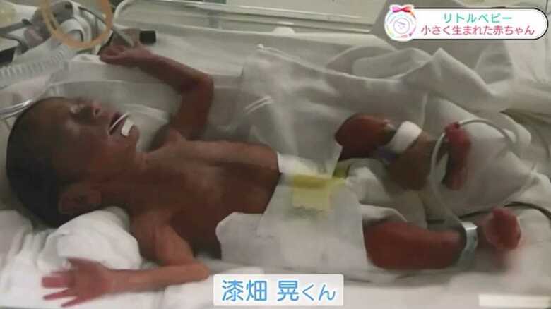出生時の晃くん