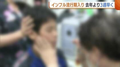 “インフル流行期”入りで感染対策の徹底呼びかけ　去年より3週早く…りんご病・百日ぜきにも引き続き注意を　新潟