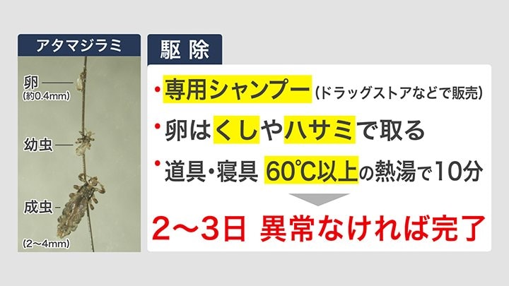 アタマジラミの駆除方法