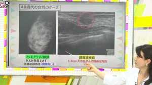 乳がん検診「異常なし」でも、日本人は安心できない!