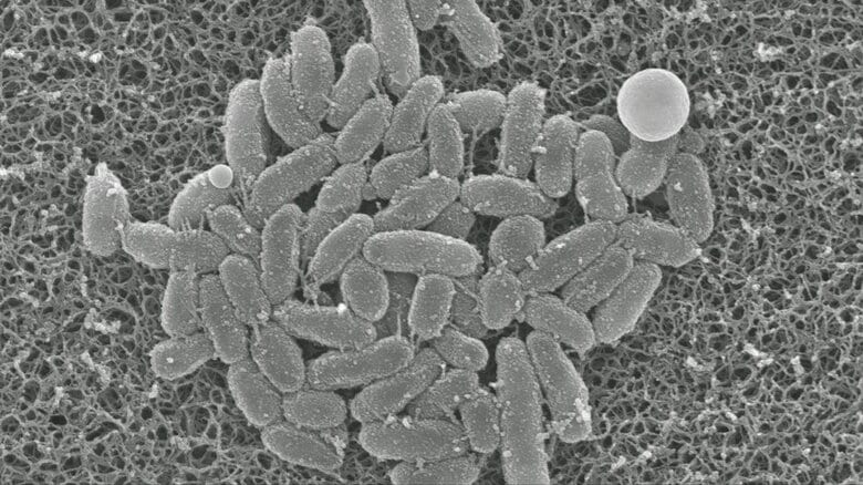 「百日ぜき」の患者1週間で104人　多い状態続く　生後6カ月以下では重症化することも　兄弟姉妹間の感染に注意を｜FNNプライムオンライン
