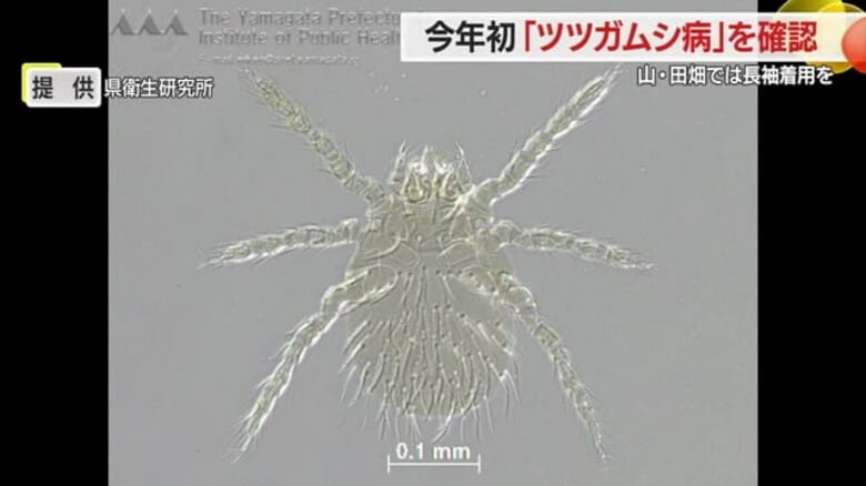 【山形】県内で今年初のツツガムシ病確認 入山時は対策を｜FNNプライムオンライン