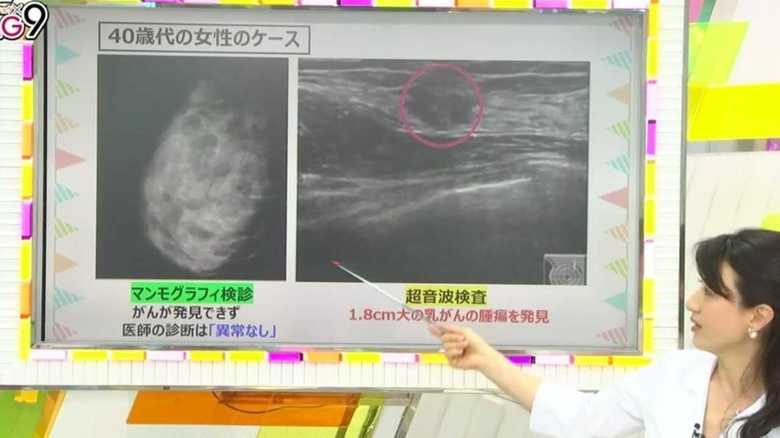 乳がん検診「異常なし」でも、日本人は安心できない!