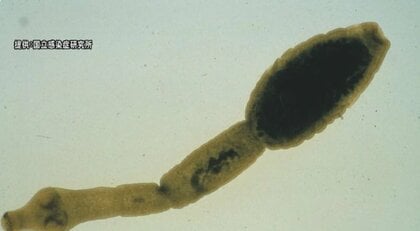 愛知で野犬の感染が相次ぐ「エキノコックス」…本州にも拡大? 専門家に見解と予防法を聞いた