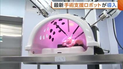 【医療】手ぶれ補正も！新潟市民病院が最新“手術支援ロボット”導入　体の負担減＆より多くの手術可能に「患者の希望に応えるべく体制整えたい」