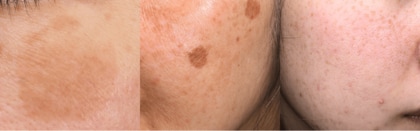 2025年版・年末の“駆け込み美容医療”ランキング調査【施術解説付】