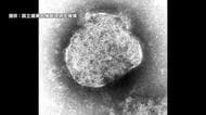 はしか感染「予防接種2回でも」　鹿児島の40代男性で確認、抗体検査を呼びかけ