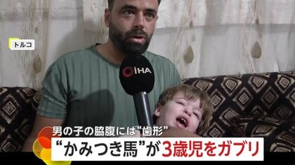 「イヤーーー！」泣き叫ぶ3歳男児の脇腹に“歯形”くっきり…“かみつき馬”の襲撃で3メートル吹っ飛ぶ　現場には「かみつきます」の注意書き　トルコ・アルタンヤ