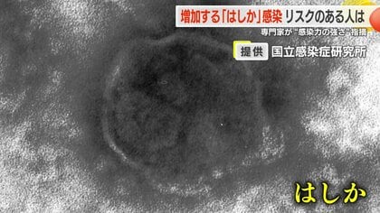 感染力はインフルエンザの10倍！ 海外で「はしか（麻疹）」が流行　特効薬もなく、重症や死亡例も