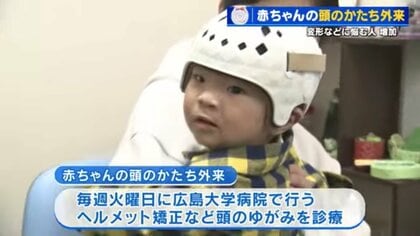 「赤ちゃんの頭の形が気になる」 ヘルメットで矯正の外来に受診者急増　生後6か月までに始めると効果的　広島大学病院