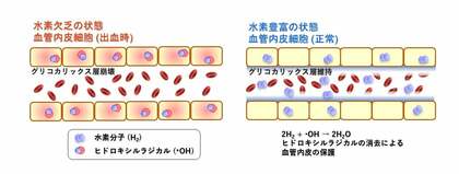 水素豊富生理食塩水が出血性ショックの血管内皮を保護し生存率を改善｜MiZ・大阪公立大学 共同研究