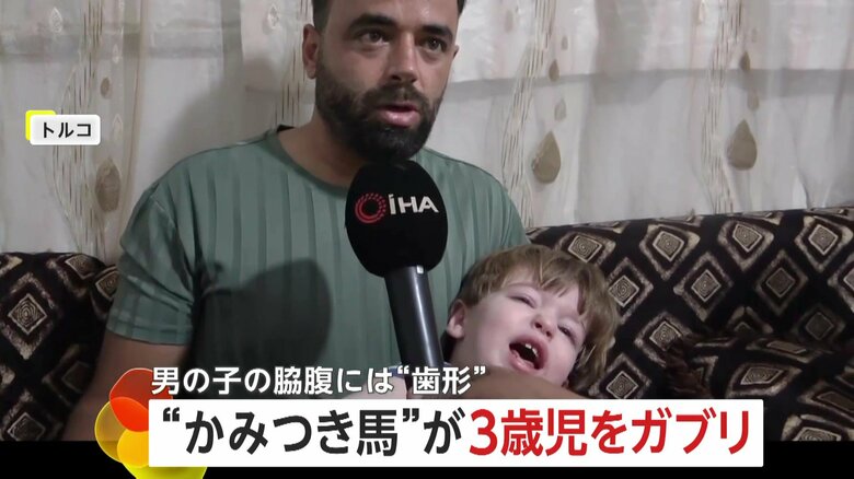 「イヤーーー！」泣き叫ぶ3歳男児の脇腹に“歯形”くっきり…“かみつき馬”の襲撃で3メートル吹っ飛ぶ　現場には「かみつきます」の注意書き　トルコ・アルタンヤ｜FNNプライムオンライン