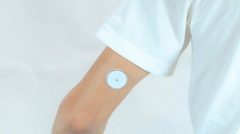 CGMはセンサーを腕に取り付ける（イメージ）