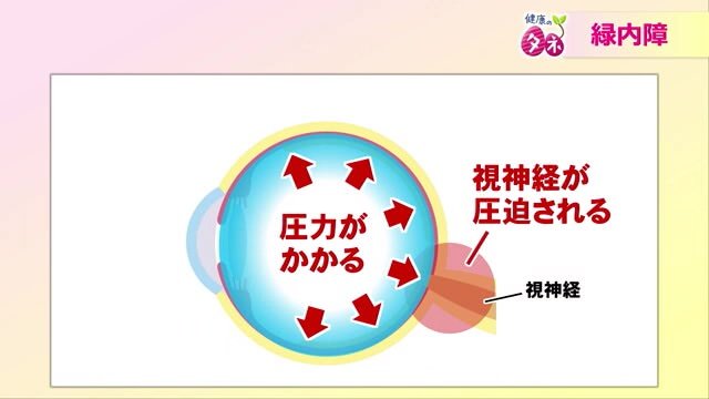 緑内障のメカニズム②