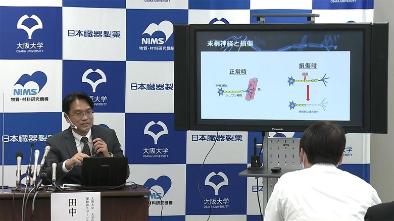 神経の再生促す治療用シート開発 大阪大学など