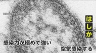 「十分な抗体なければ100％感染」世界で猛威の“はしか”　30～40代のワクチン接種希望者も急増