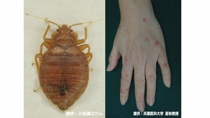 韓国で2023年後半問題に…日本にも持ち込まれている「トコジラミ」人の血を吸い判断材料は“黒いシミ”