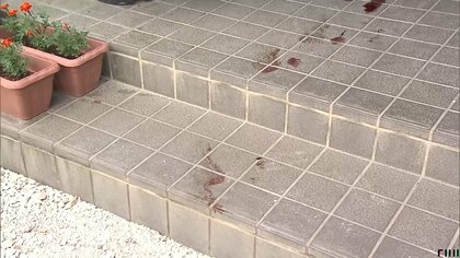 栃木・那須塩原市で70代男性が体長1.5メートルの熊に襲われ後頭部から首にかけ約30cmの裂傷負う　先週は岩手・北上市や福井・勝山市などで目撃