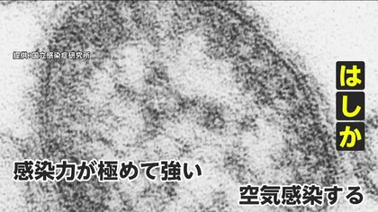 「十分な抗体なければ100％感染」世界で猛威の“はしか”　30～40代のワクチン接種希望者も急増