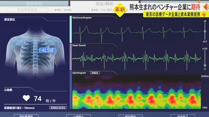心音聞くだけじゃない“超聴診器”　国内最大規模のデータベース保有企業と業務提携　心疾患の早期発見・治療に期待【熊本発】