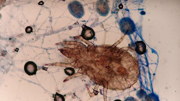 春と秋の大掃除が「ダニを減らすサイクル」を生む!?重点的に叩くべき場所とアレルゲンごと取り除く掃除機のかけ方|FNNプライムオンライン