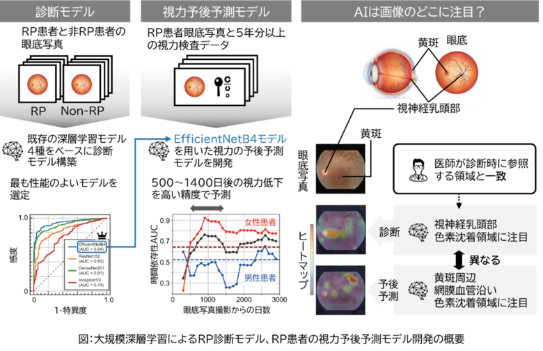 AIで網膜色素変性症患者の数年後の視力を予測ー眼底写真大規模深層学習モデルを利用した視力予後予測モデルを開発ー