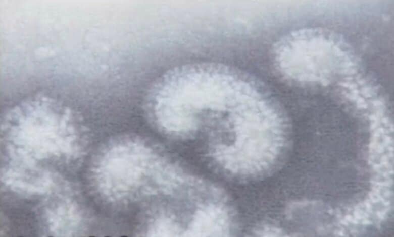 鳥インフルエンザ