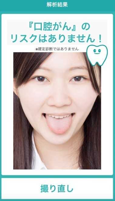 口腔疾患を発見する機能を用いたデモアプリ