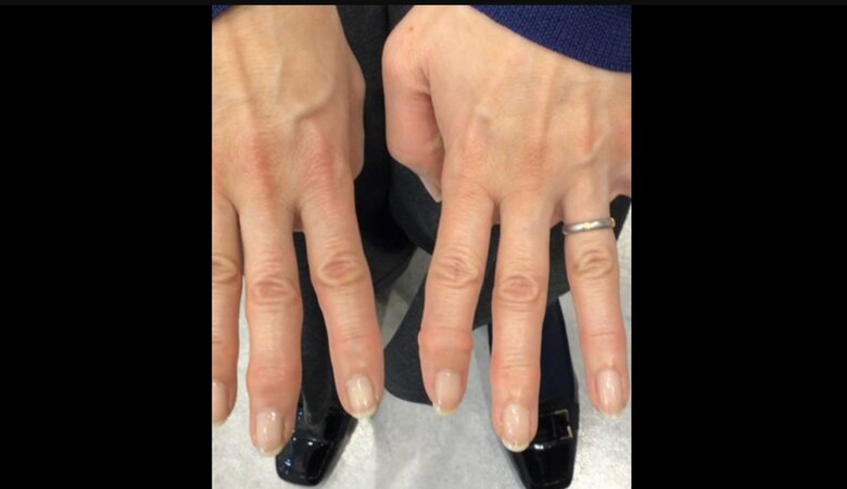 （提供：オクノクリニック銀座）