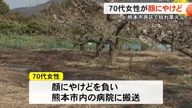 剪定した枝などを燃やしたら燃え広がって火災に　７０代女性が顔にやけど【熊本】
