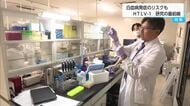 白血病の発症リスクになるウイルス　HTLV−1　研究の最前線