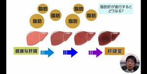 果物はお菓子よりも悪い!?肝臓がんの原因となる「脂肪肝」の仕組みと予防法について専門医が解説