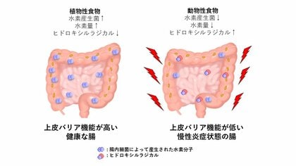 なぜ潰瘍性大腸炎は増え続けるのか？ ― 食生活の変化と腸内水素の減少に着目した新仮説 ―