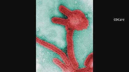 日本は大丈夫？“致死率88％”の「マールブルグ病」赤道ギニアで感染拡大…厚労省が注意喚起